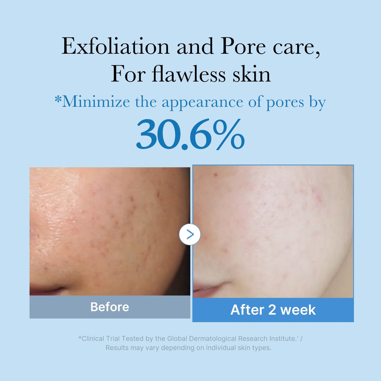 zero-pore-toner-w5 01_d6480b4e-3c08-4954-994a-ed5212c1839c.jpg