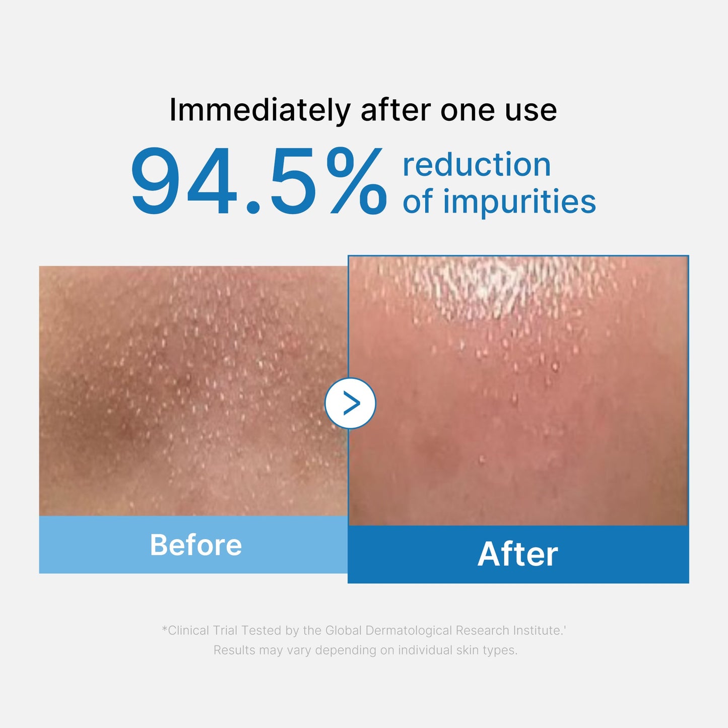 zero-pore-blackhead-deep-cleansing-oil-a3 01_eed557ec-5857-46a2-8b17-dbd67c692dcb.jpg