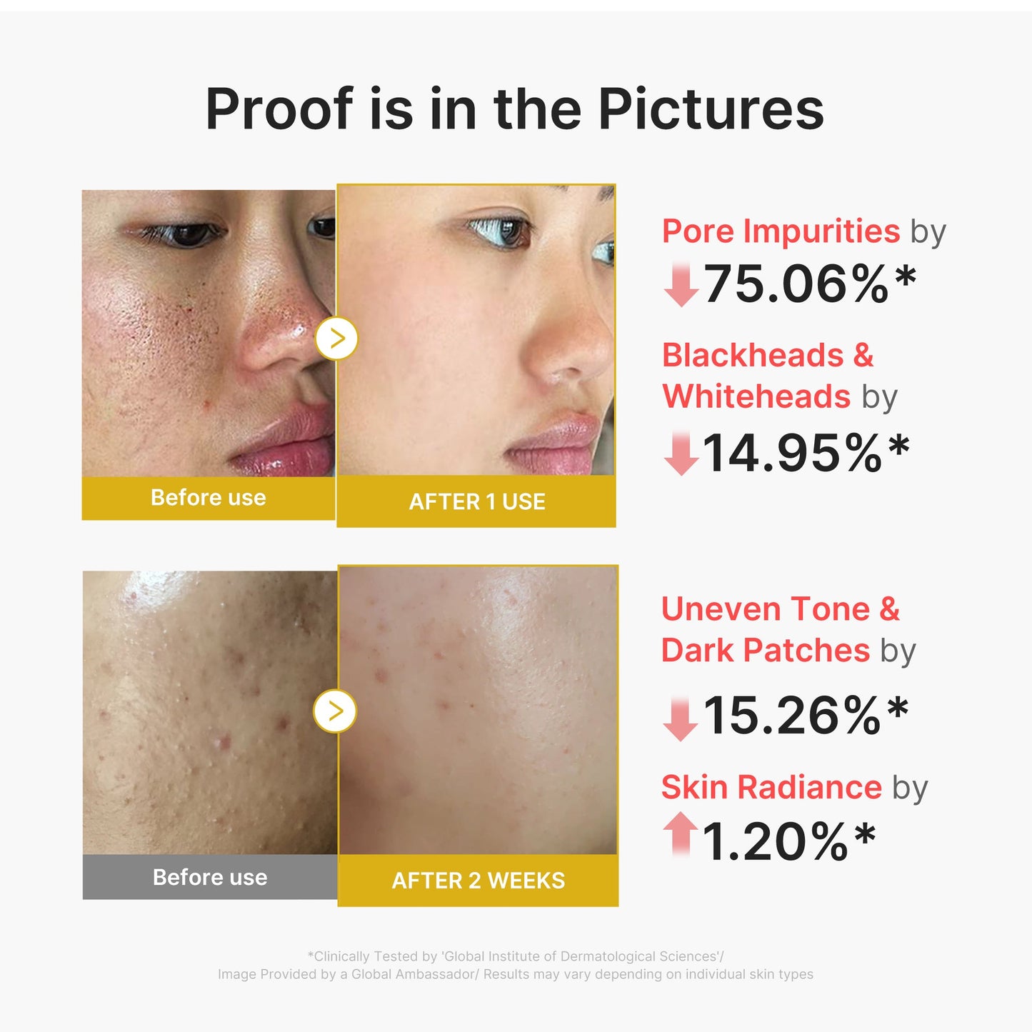kojic-acid-turmeric-peel-shot-g4 02_45fe66d3-b3f6-4100-aa52-2afd7eded417.jpg