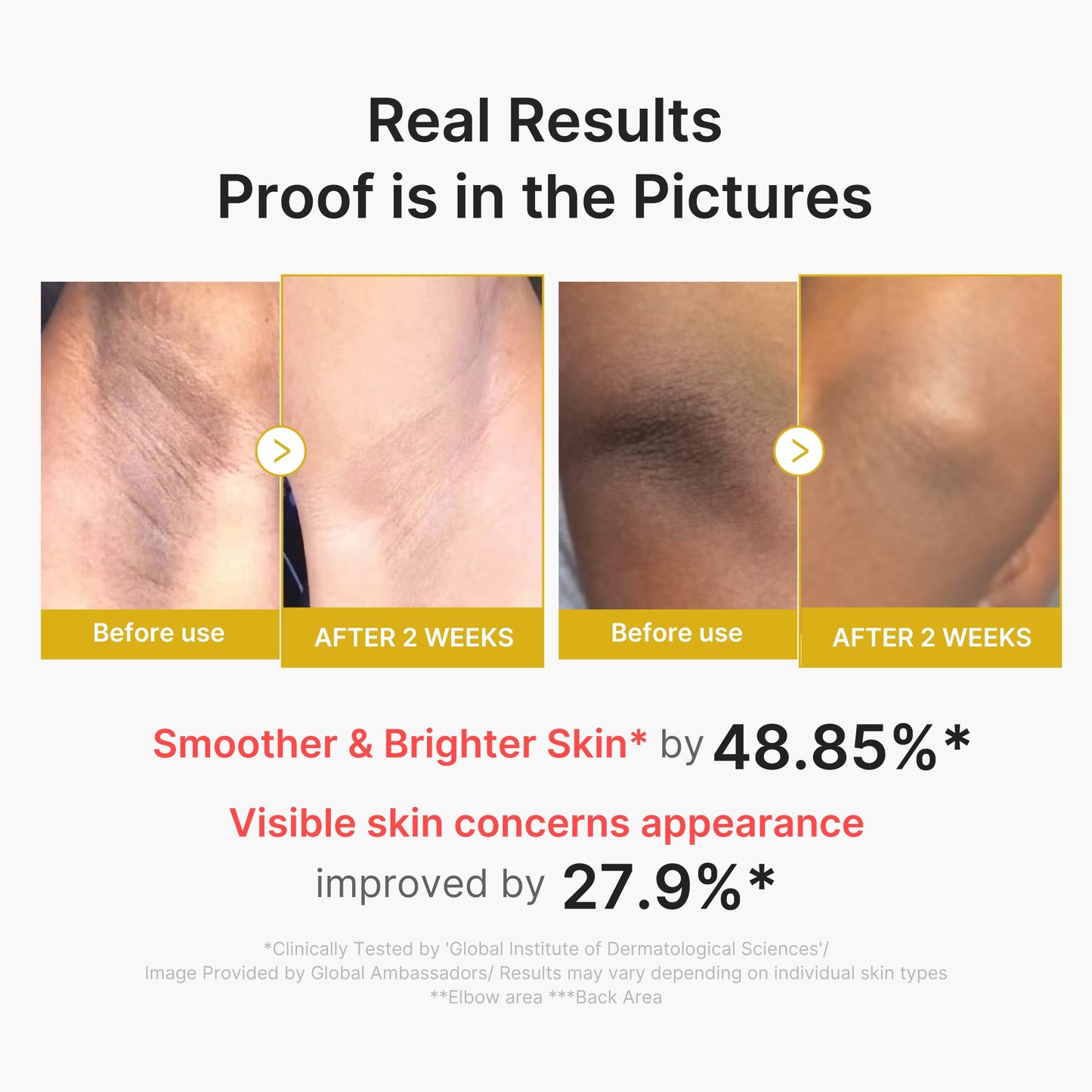 kojic-acid-turmeric-body-peel-shot-c8 02_72880cfc-382b-440b-8152-7e3dce87da2a.jpg