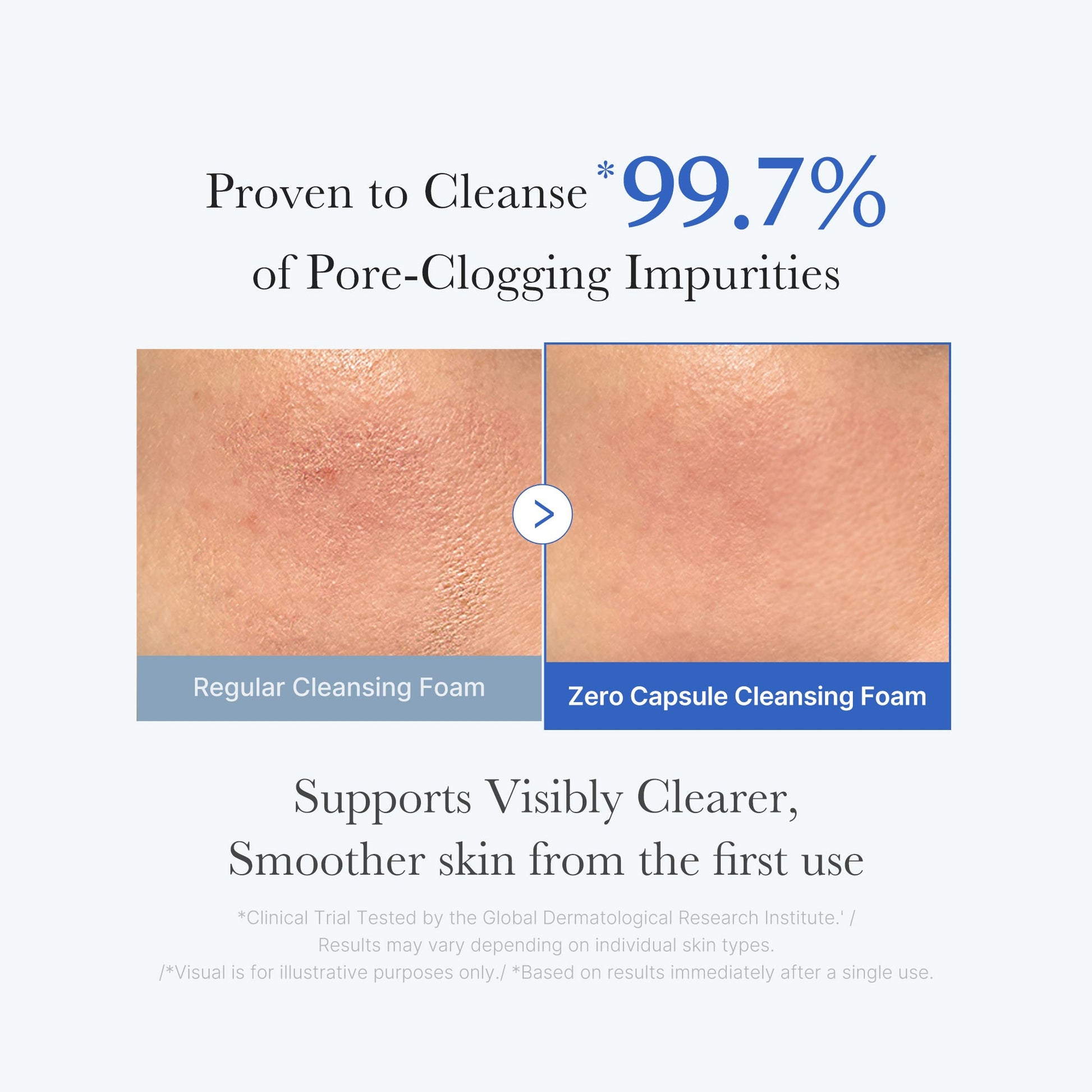 zero-pore-capsule-cleansing-foam-v7 02_c1fb9dfb-86c5-4038-8ff8-490d1006276c.jpg