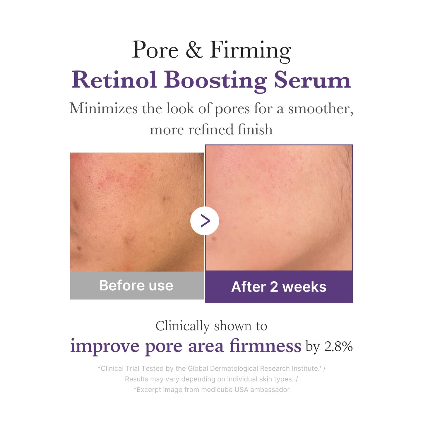 retinol-nmn-boosting-serum-o1 03_3510e7a5-5633-4a18-81ea-1389593bd517.jpg