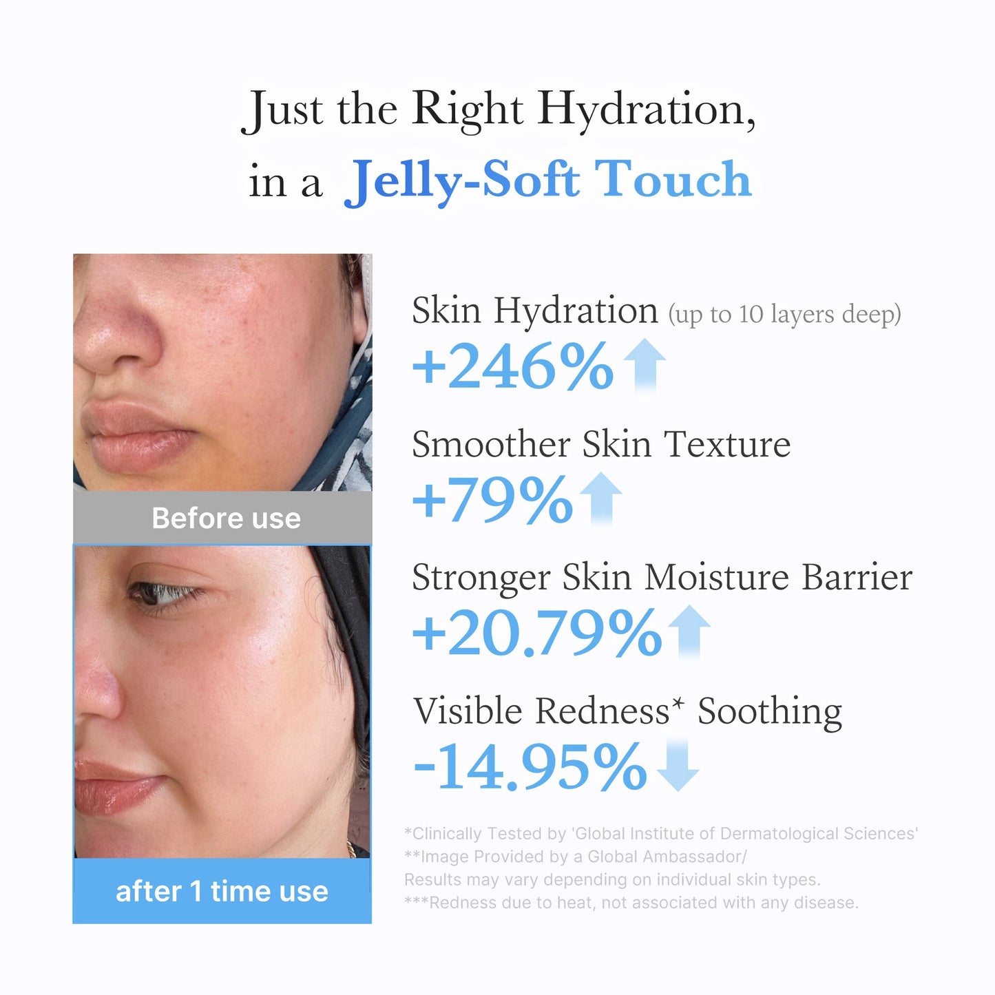 hyaluronic-ceramide-moisturizing-jelly-cream-y7 03_c39d66cc-0839-4e48-ab4a-d32143d06b1c.jpg