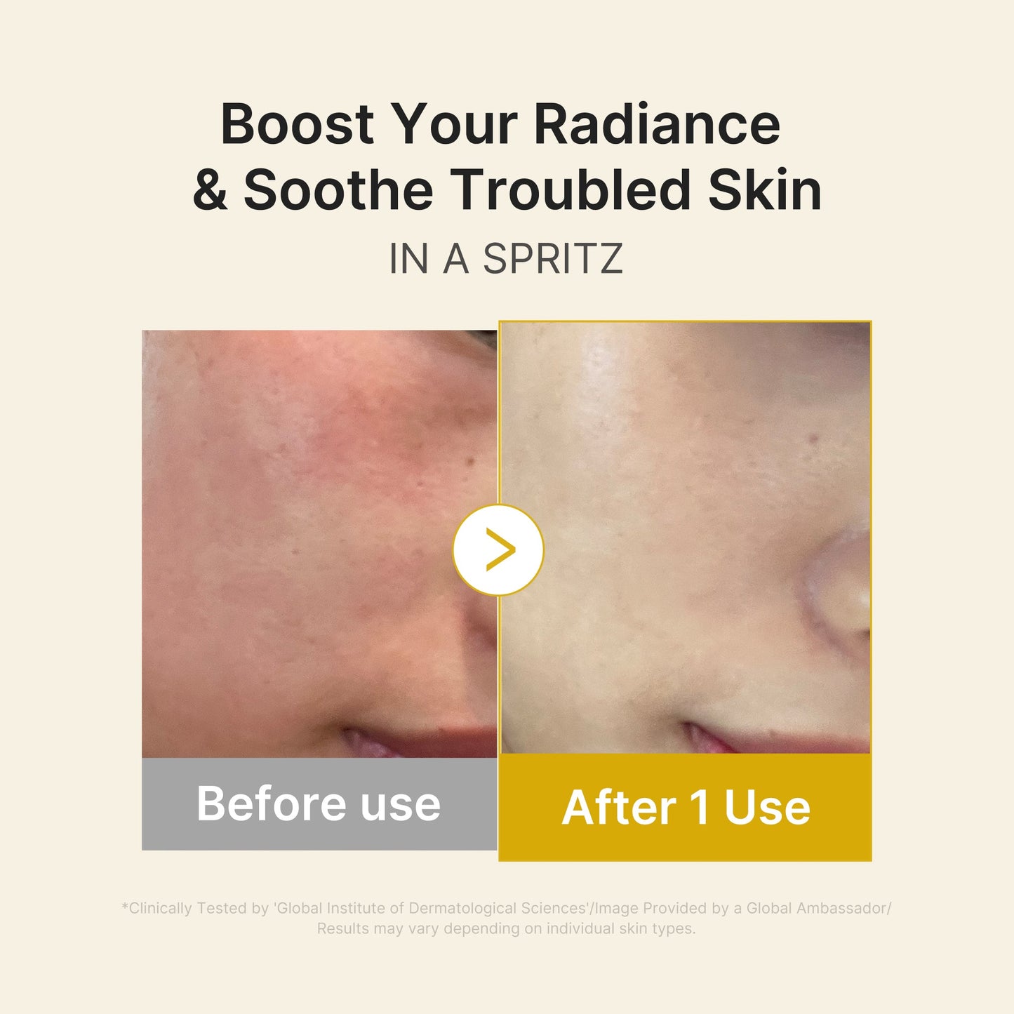 kojic-acid-turmeric-vitamin-gold-jelly-mist-serum-b4 03_dc9cd19e-4e57-49d3-9b66-c7762e8a63f1.jpg