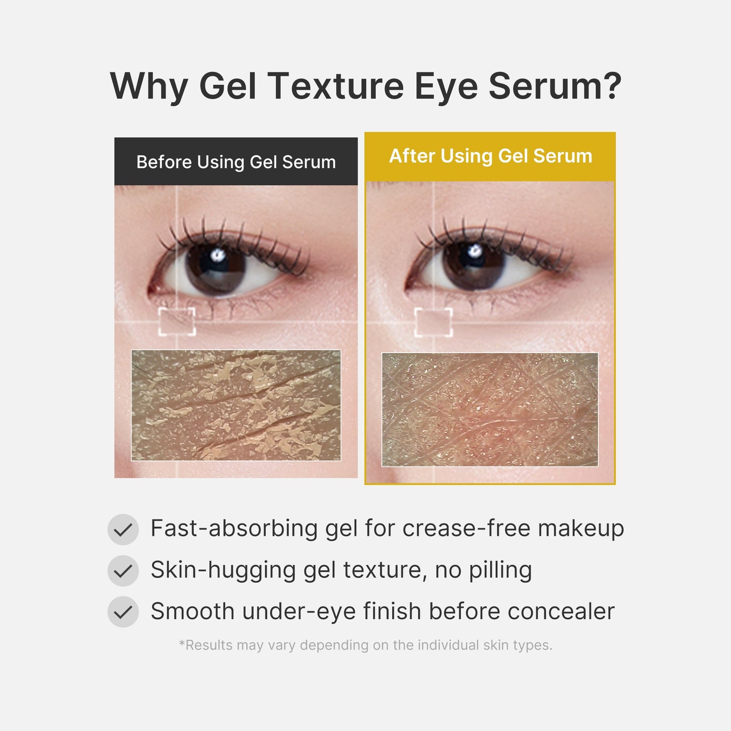 kojic-acid-tumeric-eye-gel-serum-k8 04_0487ef36-49f4-4294-8049-bb55118b05fe.jpg