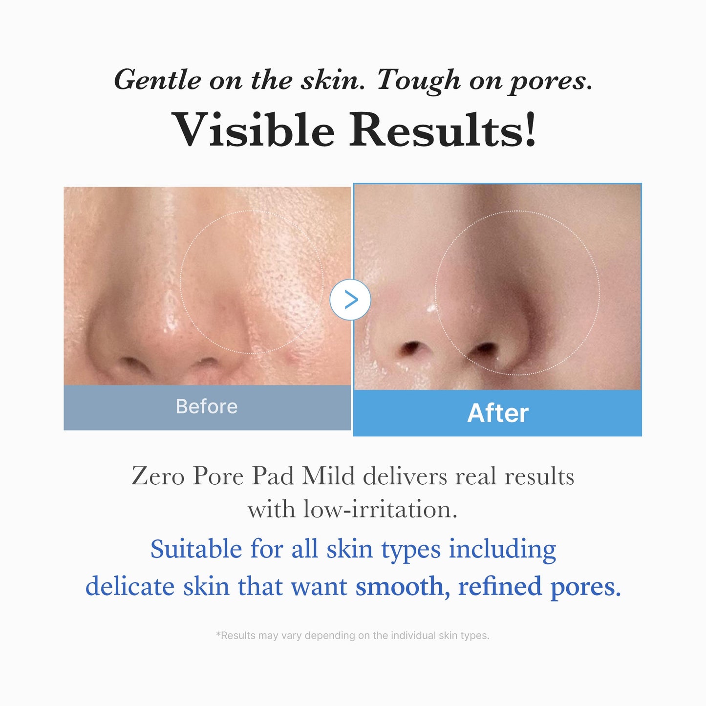 zero-pore-madecassoside-pads-mild-k9 04_6357f9f9-483b-4891-82c6-a58d336e62c8.jpg