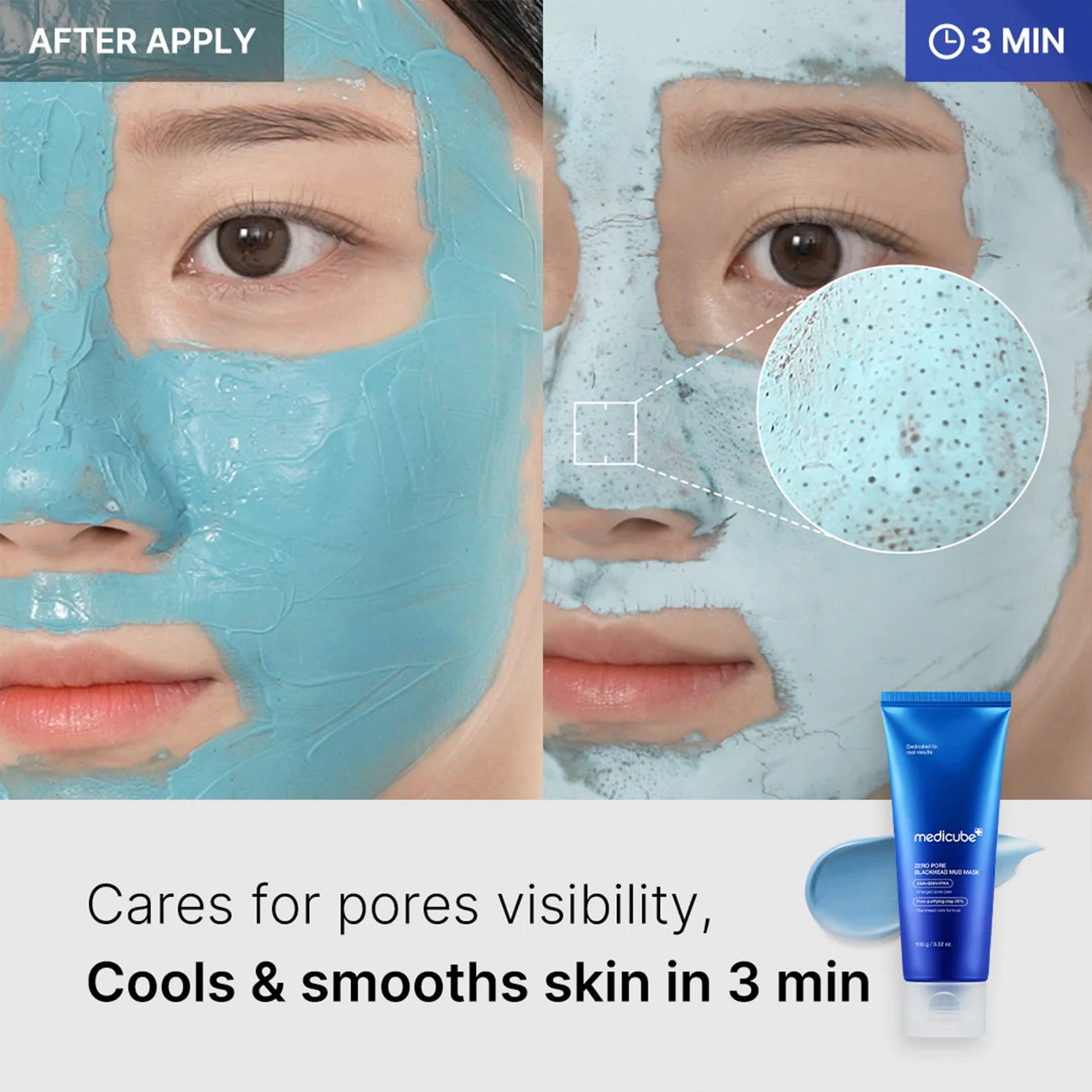 zero-pore-blackhead-mud-mask-l4 04_867c0459-a94e-40d3-bd9a-70400edabe8d.jpg