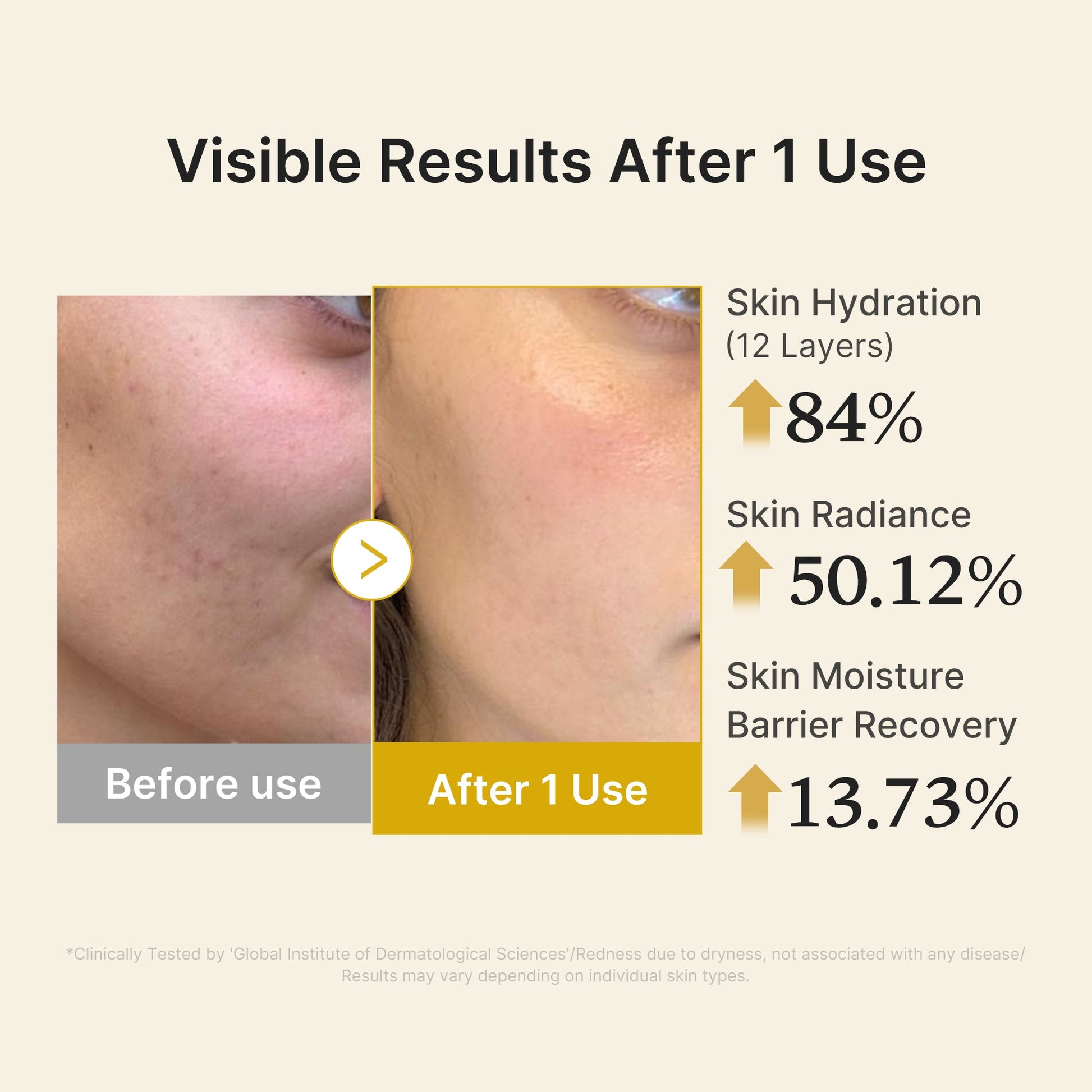 kojic-acid-turmeric-vitamin-gold-jelly-mist-serum-b4 04_d5c55ef1-e03b-494d-bc0d-a1ecc7fc2abf.jpg