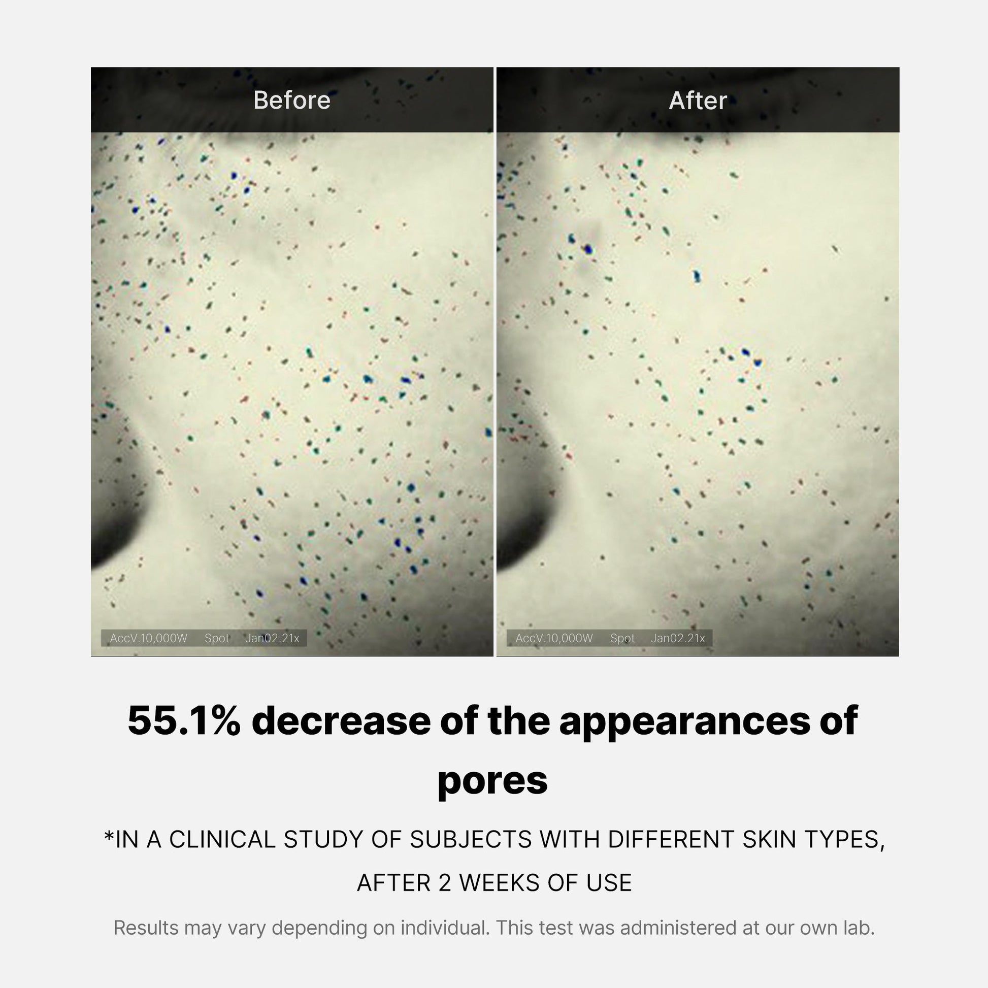 pore-care-duo-i0 05_12ddab8a-64be-4612-8ee1-27e5ec701921.jpg