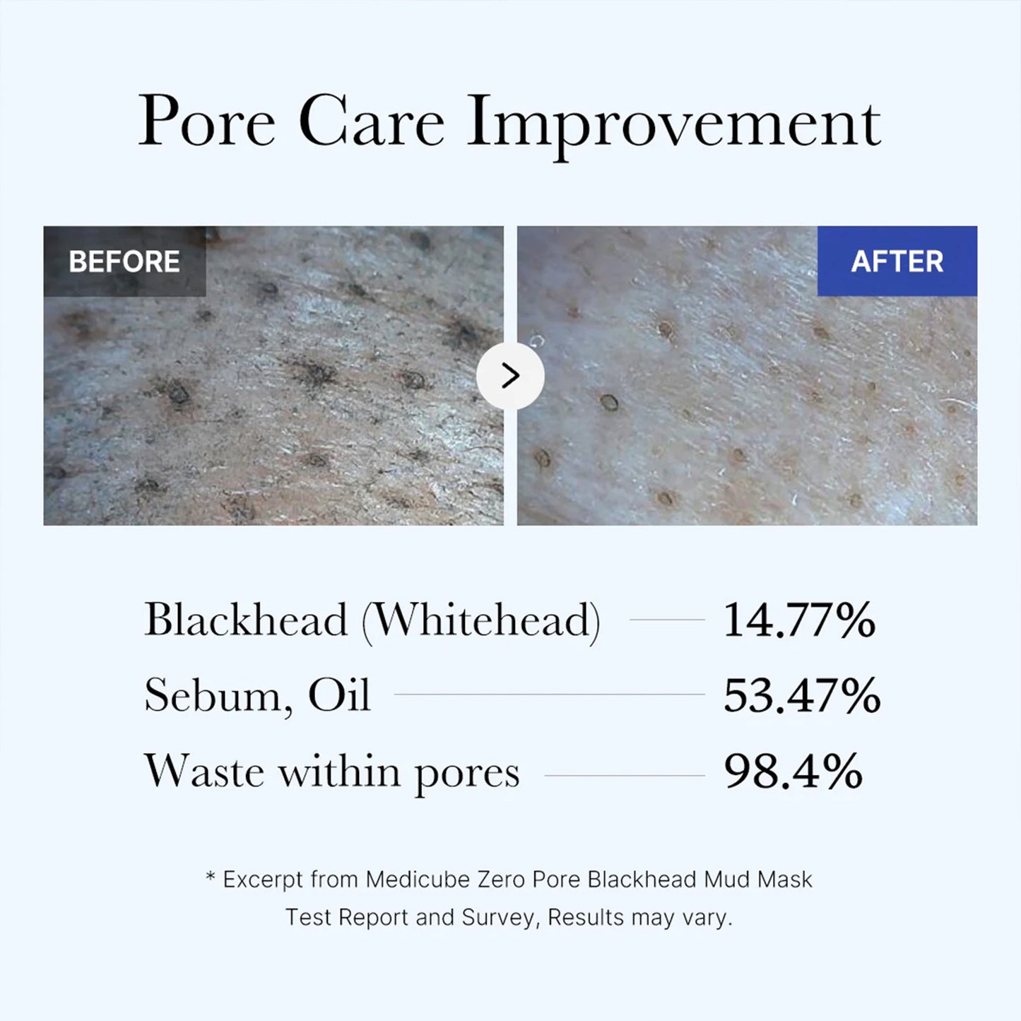 zero-pore-blackhead-mud-mask-l4 05_9362a158-c2b3-4525-acc0-631a2cfdea47.jpg