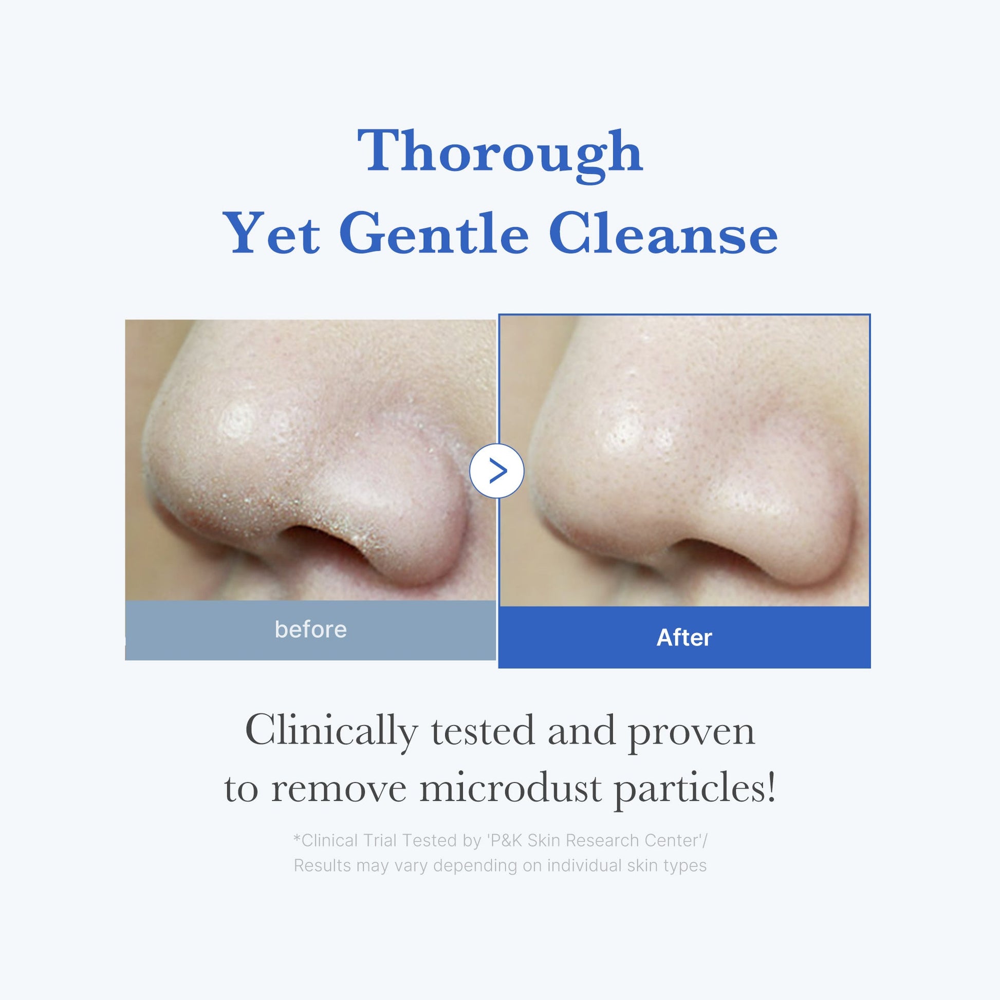 zero-foam-cleanser-b8 250702_ZeroCleanser3.jpg