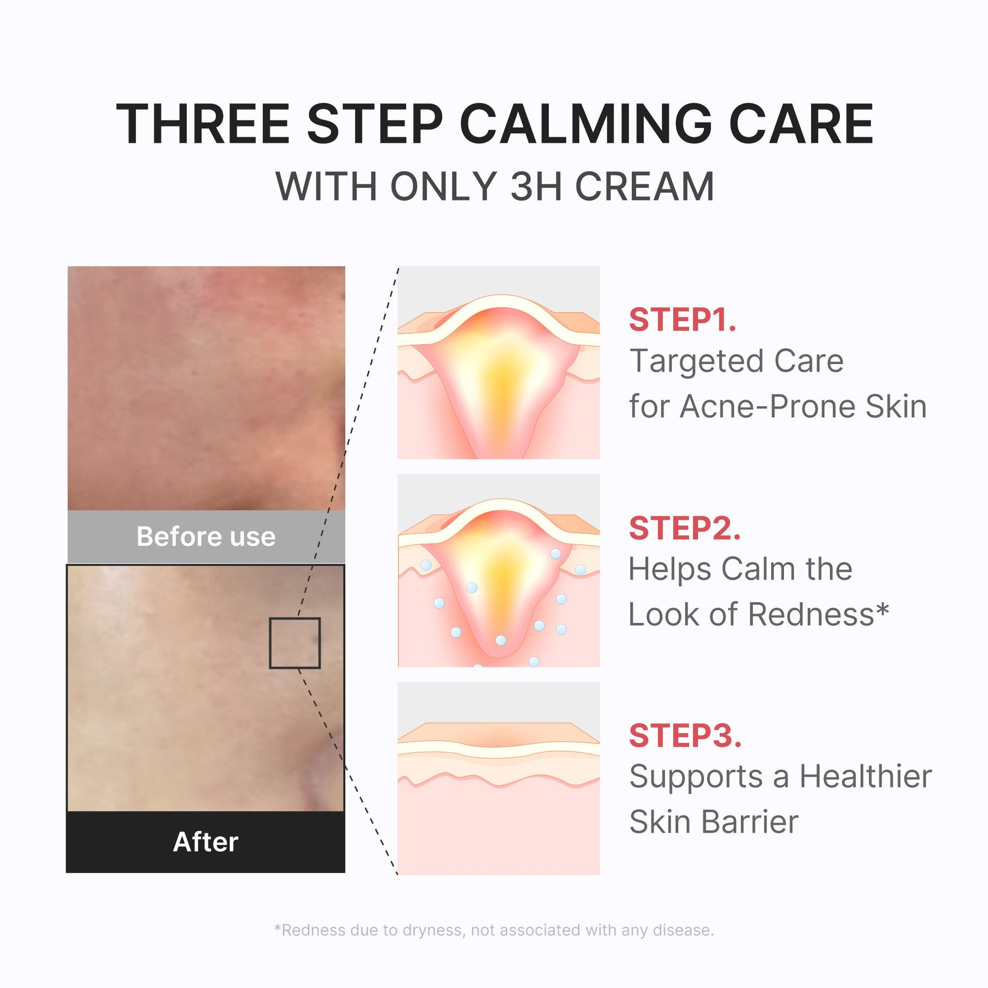 3h-daily-relief-cream-s0 3H_04.jpg