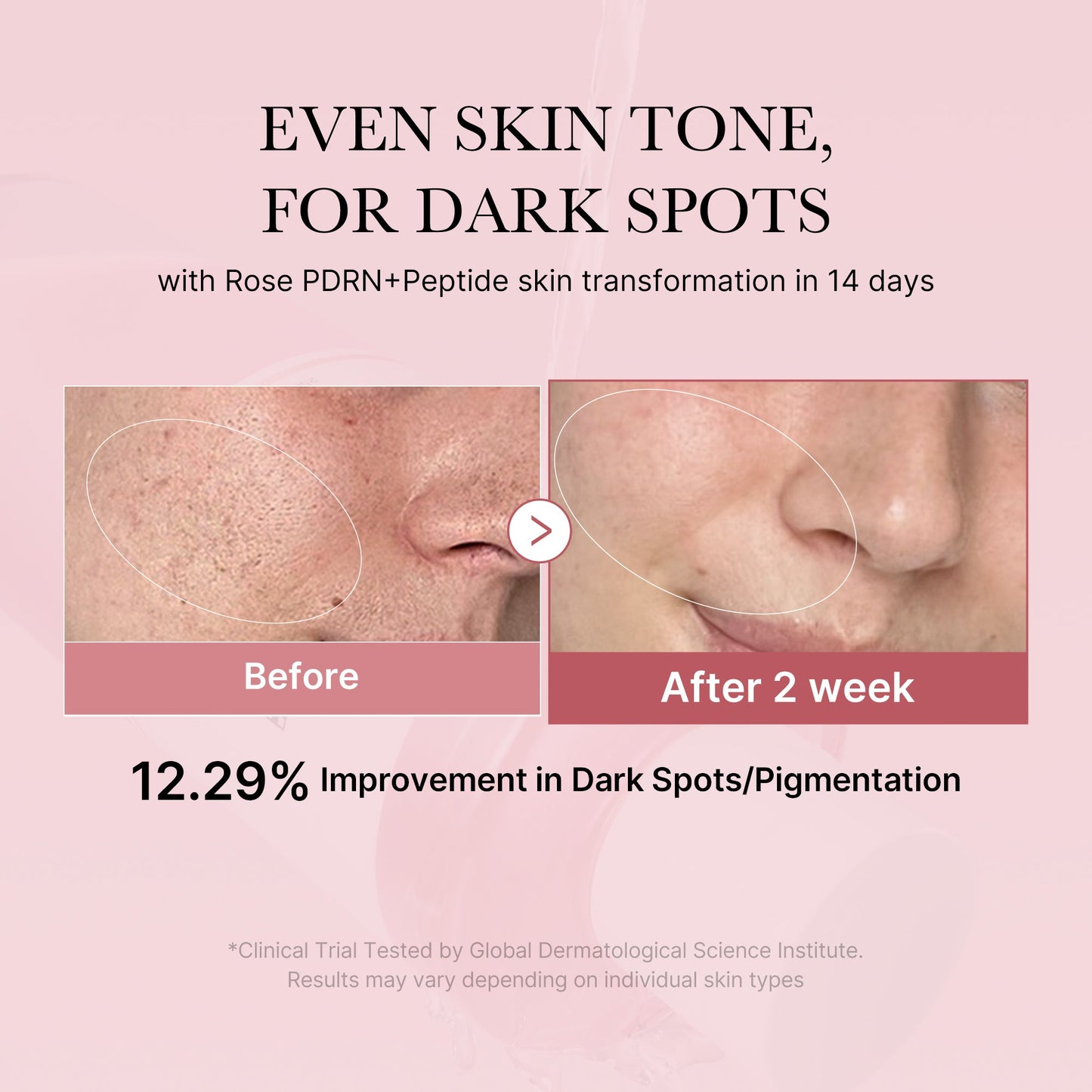pdrn-pink-peptide-toner-m9 PDRN_01_308c518e-5ac6-4e54-99bd-eabc8796739b.jpg