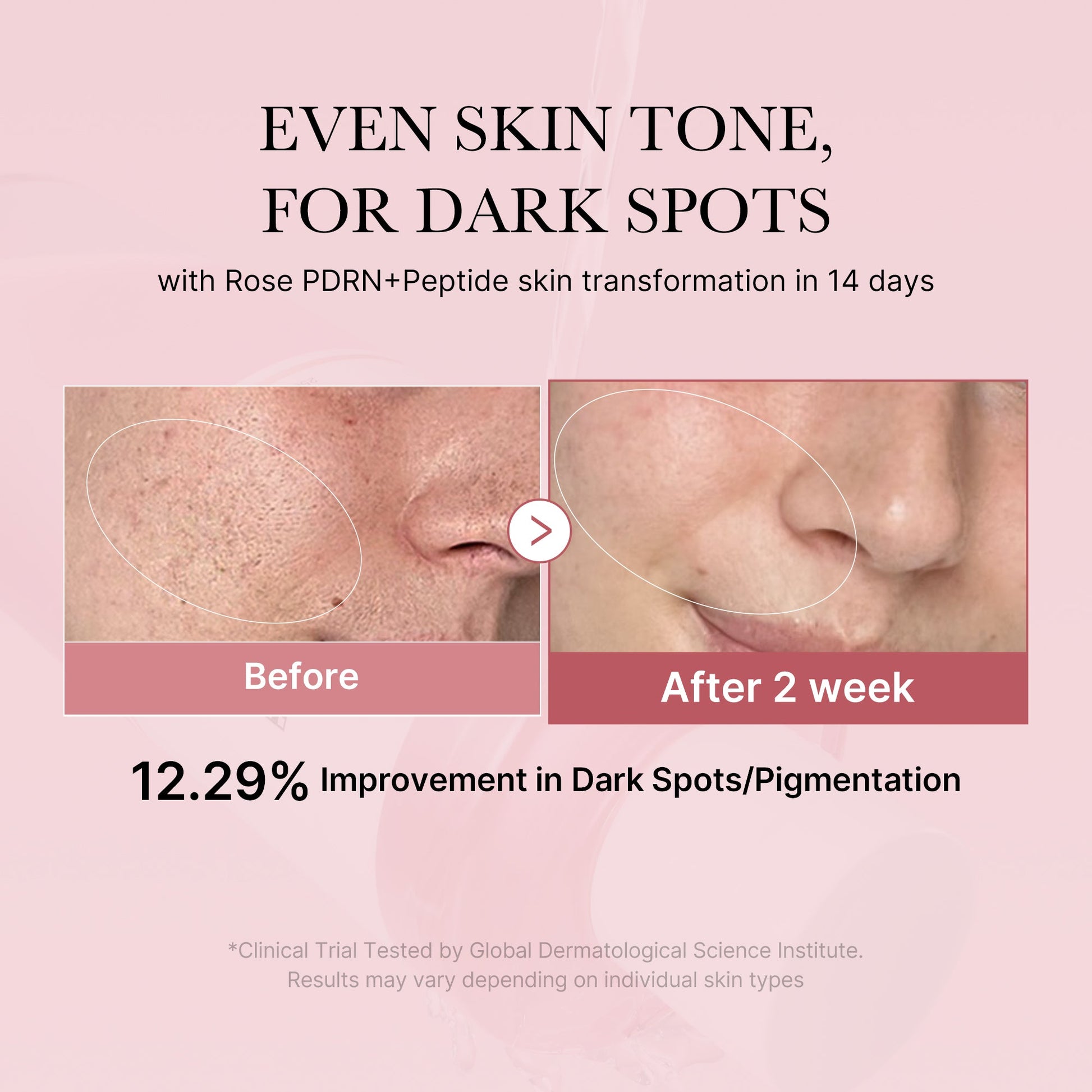 pdrn-pink-peptide-toner-m9 PDRN_01_308c518e-5ac6-4e54-99bd-eabc8796739b.jpg