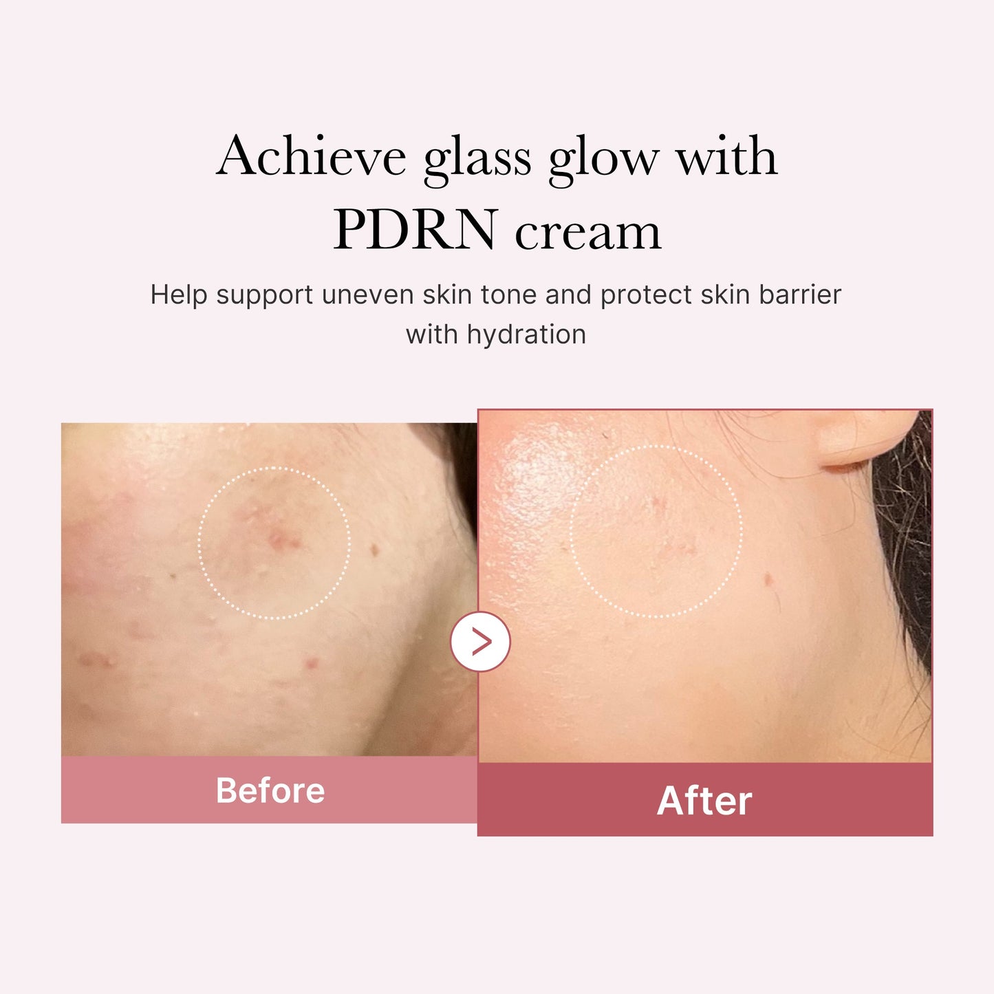 pdrn-pink-peptide-cream-w6 PDRN_02_d7805bfe-cf43-446a-b71b-a276683f136b.jpg