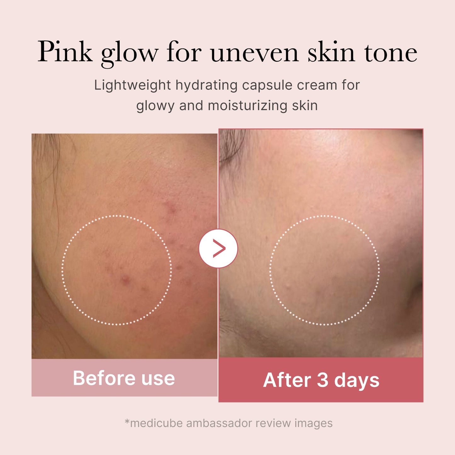 pdrn-pink-collagen-capsule-cream-v5 PDRN_03_058d09d8-4f44-4b1e-927c-e27b1738ae51.jpg
