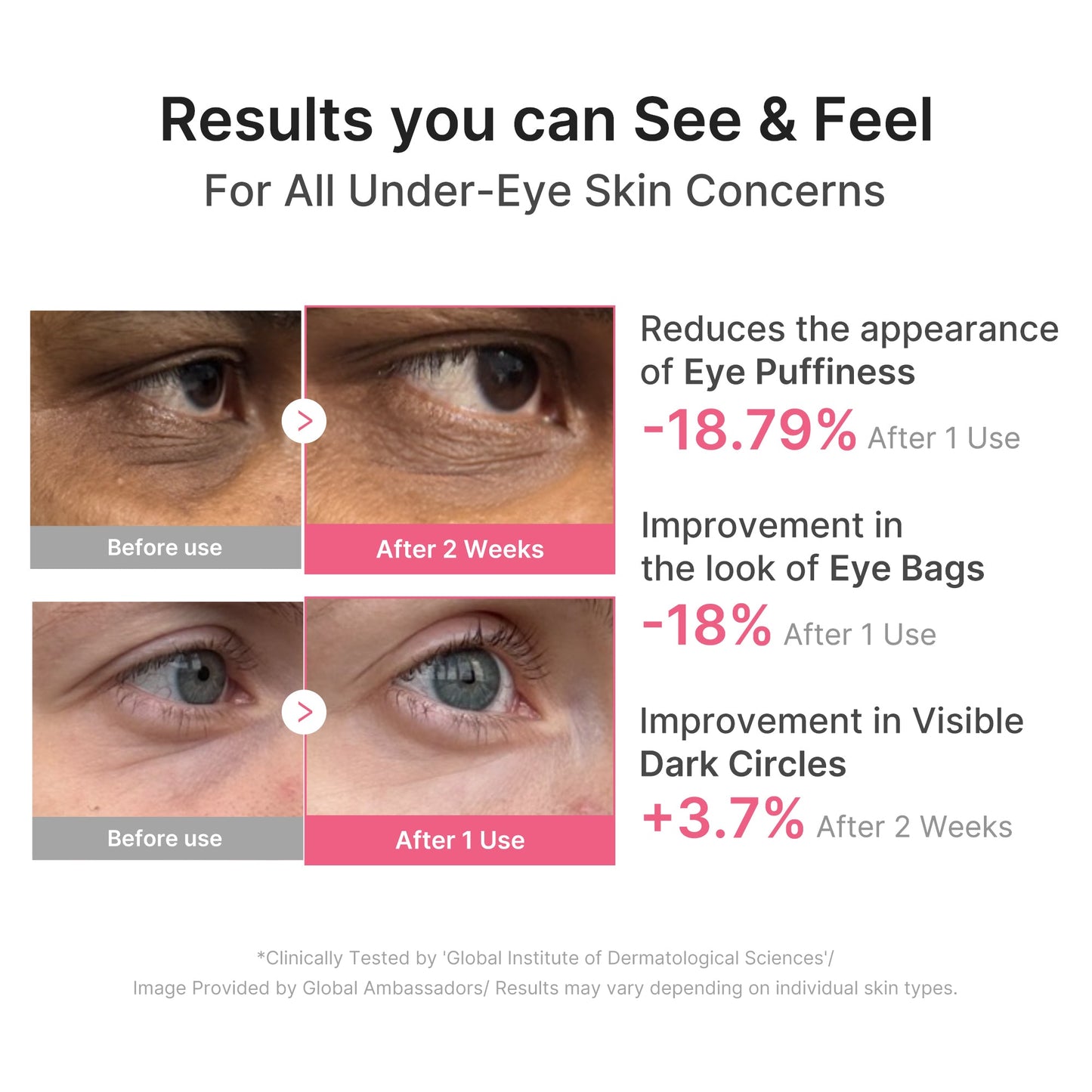 pdrn-caffeine-collagen-eye-patch-s8 PDRN_03_cdce2143-b8d8-43cb-ac69-fcbdf6640249.jpg