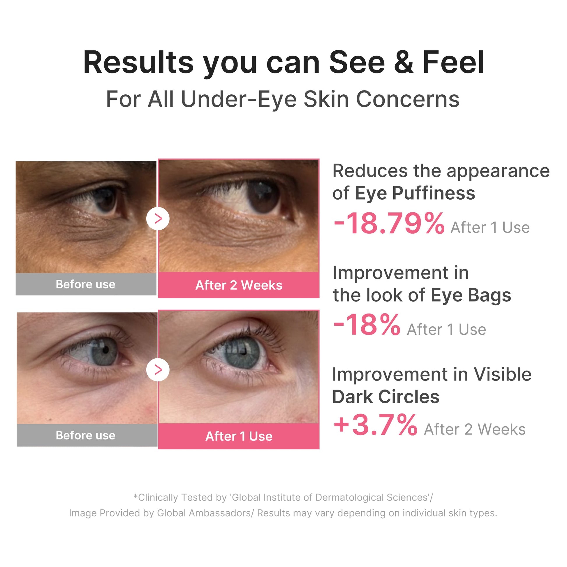 pdrn-caffeine-collagen-eye-patch-s8 PDRN_03_cdce2143-b8d8-43cb-ac69-fcbdf6640249.jpg