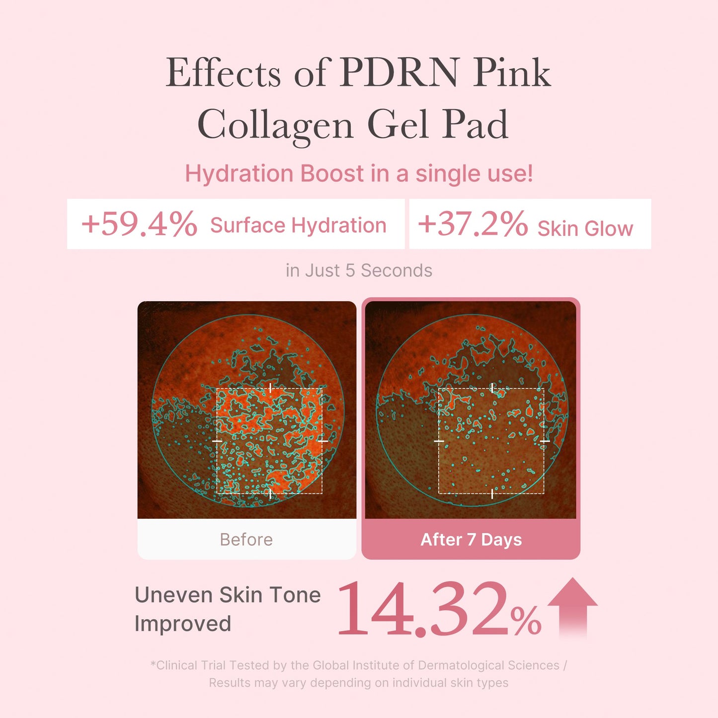pdrn-pink-collagen-gel-toner-pad-s8 PDRN_04_f9a16a56-8d9e-4c47-a635-ed34ec3ed571.jpg