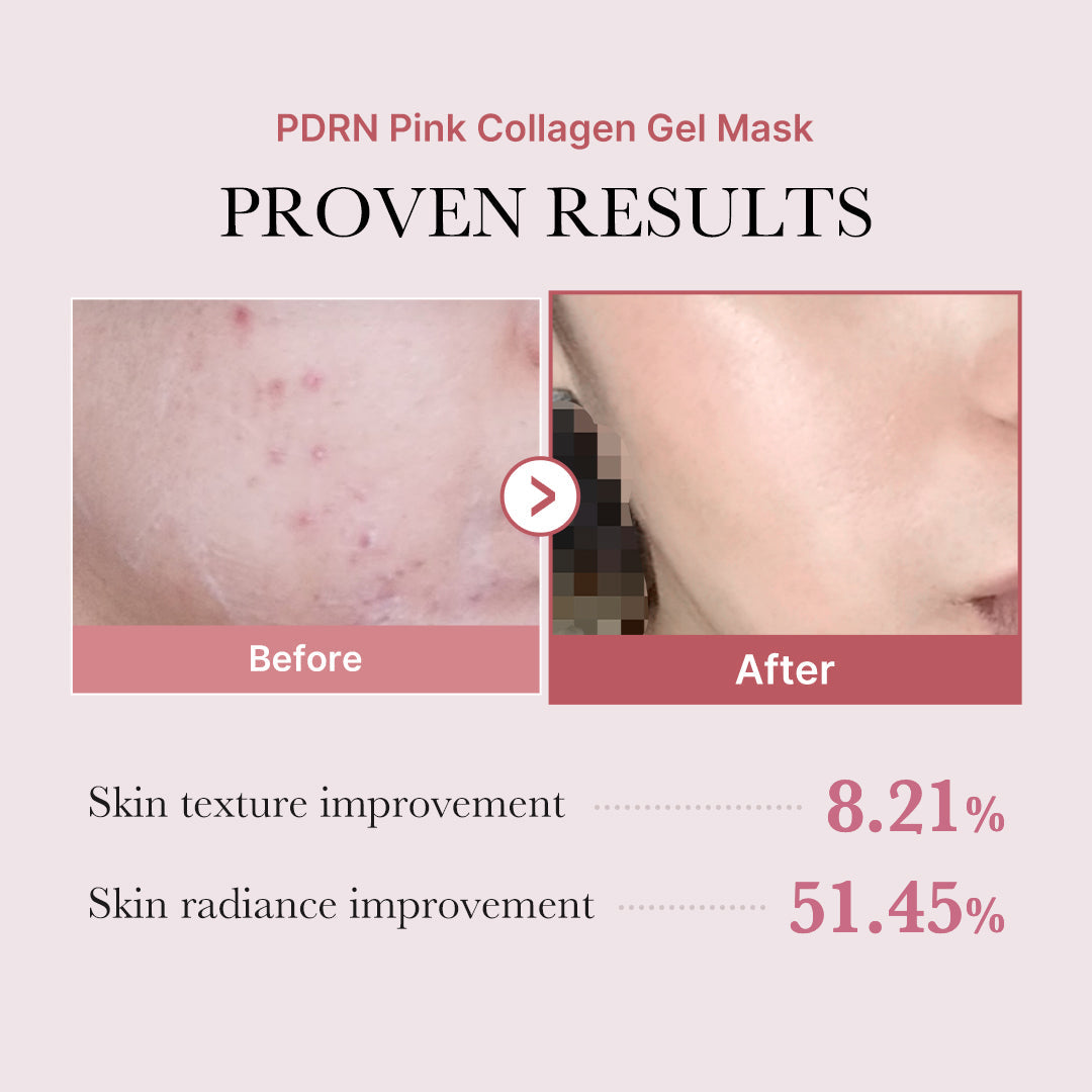 pdrn-pink-glow-full-set-i1 PDRN_12.jpg