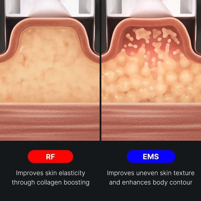 age-r-contour-body-shot-c2 img.webp